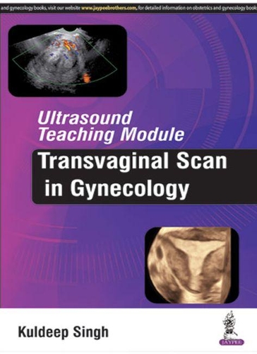 Паперова книга «Ultrasound Teaching Module: Transvaginal Scan in Gynecology», автор Кулдіп Сінгх - фото №1