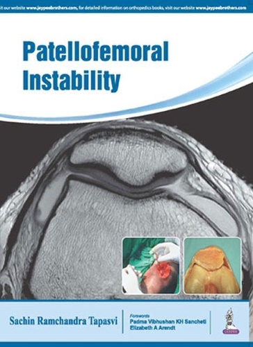 Паперова книга «Patellofemoral Instability», автор Сачін Тапасві - фото №1