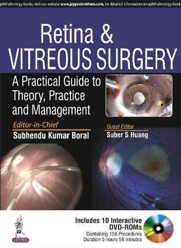 Паперова книга «Retina & Vitreous Surgery: A Practical Guide to Theory, Practice and Management», авторів Субер С Хуанг, Субхенду Кумар Борал - фото №1