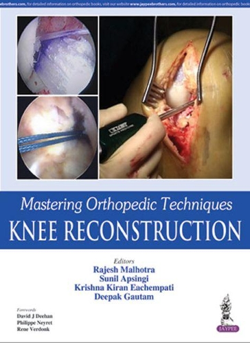 Паперова книга «Mastering Orthopedic Techniques: Knee Reconstruction», авторів Діпак Гаутам, Крішна Кіран Еачемпаті, Раджеш Малхотра, Суніл Апсінгі - фото №1
