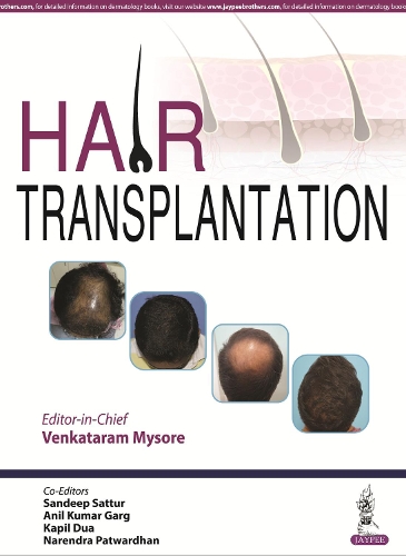 Бумажная книга «Hair Transplantation», автор Венкатарам Майсур - фото №1