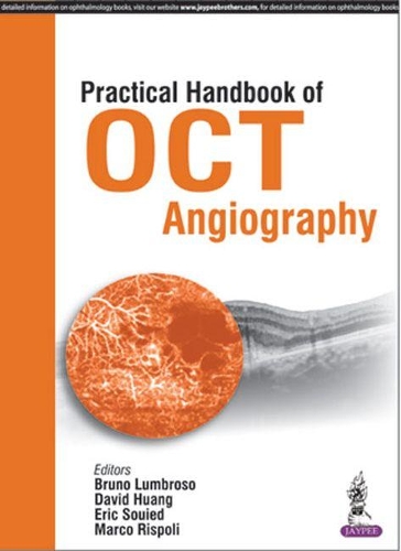 Паперова книга «Practical Handbook of OCT Angiography», авторів Бруно Лумброзо, Девід Хуанг, Ерік Суїд, Марко Рісполі - фото №1