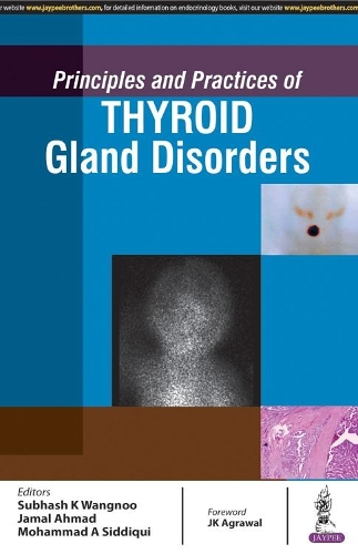 Бумажная книга «Principles and Practices of Thyroid Gland Disorders», авторов Джамал Ахмад, Мохаммад Асим Сиддики, Субхаш Кумар Вангну - фото №1