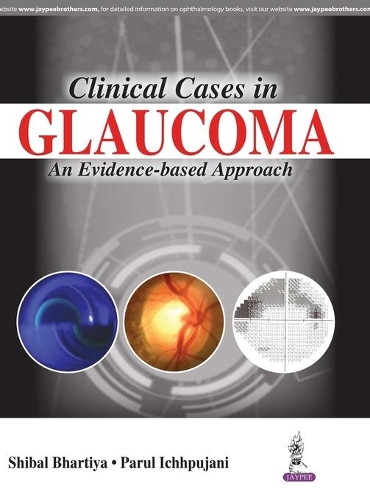 Бумажная книга «Clinical Cases in Glaucoma: An Evidence Based Approach», авторов Парул Ичхпуджани, Шибал Бхартия - фото №1
