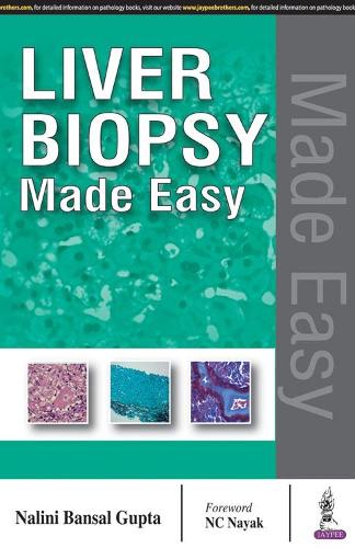 Бумажная книга «Liver Biopsy Made Easy», автор Налини Бансал Гупта - фото №1