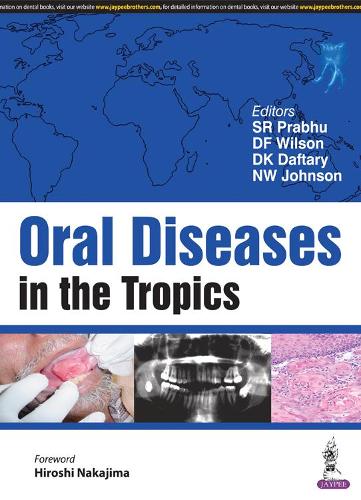 Бумажная книга «Oral Diseases in the Tropics», авторов Д Ф Уилсон, Д К Дафтари, Х. У. Джонсон, Ш. Р. Прабгу - фото №1