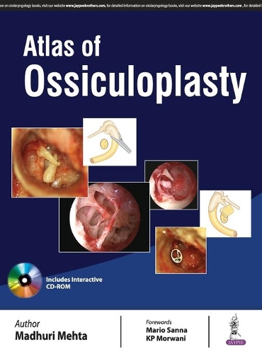 Бумажная книга «Atlas of Ossiculoplasty», автор Мадхури Мехта - фото №1