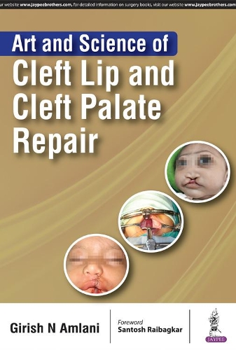 Бумажная книга «Art and Science of Cleft Lip and Cleft Palate Repair», автор Гириш Н Амлани - фото №1