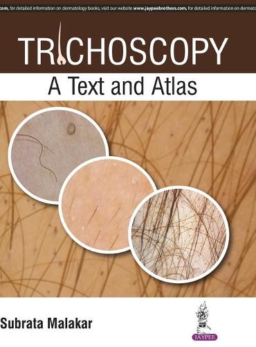 Бумажная книга «Trichoscopy: A Text and Atlas», автор Субрата Малакар - фото №1