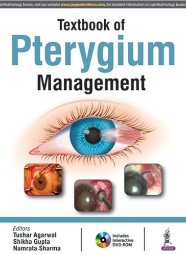 Бумажная книга «Textbook of Pterygium Management», авторов Намрата Шарма, Шикха Гупта, Тушар Агарвал - фото №1