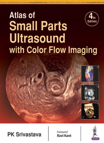 Бумажная книга «Atlas of Small Parts Ultrasound: with Color Flow Imaging», автор П. К. Шривастава - фото №1