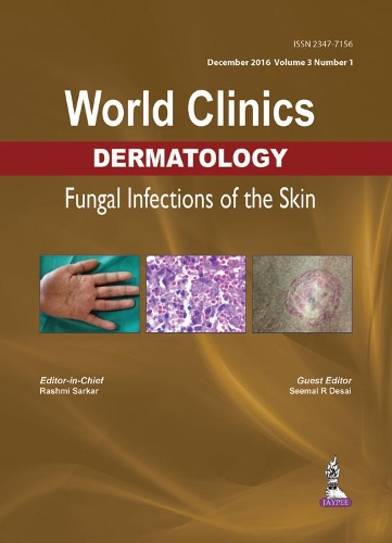 Бумажная книга «World Clinics Dermatology: Fungal Infections of the Skin: Volume 3, Number 1», авторов Рашми Саркар, Симал Р. Десаи - фото №1