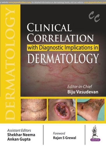 Бумажная книга «Clinical Correlation with Diagnostic Implications in Dermatology», автор Биджу Васудеван - фото №1