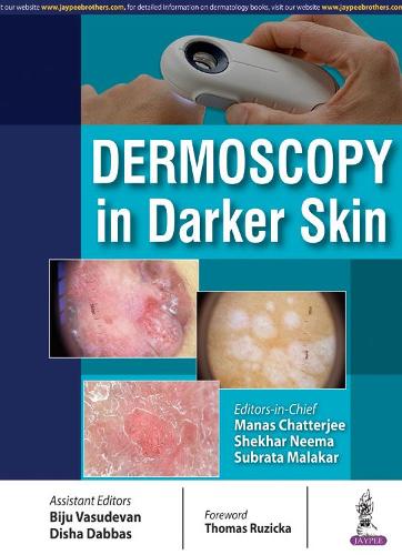 Бумажная книга «Dermoscopy in Darker Skin», авторов Манас Чаттерджи, Шекхар Нима, Субрата Малакар - фото №1