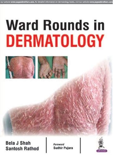 Бумажная книга «Ward Rounds in Dermatology», авторов Бела Джей Шах, Сантош Ратход - фото №1