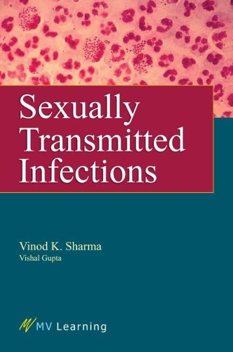 Паперова книга «Sexually Transmitted Infections», авторів Винод К. Шарма, Вішал Гупта - фото №1
