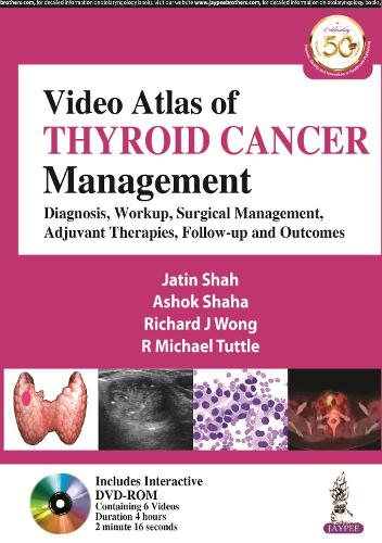Paper book «Video Atlas of Thyroid Cancer Management: Diagnosis, Workup, Surgical Management, Adjuvant Therapies, Follow-up and Outcomes», authors Ashok Shaha, Jatin Shah, R Michael Tuttle, Richard J Wong - фото №1