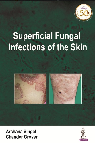 Бумажная книга «Superficial Fungal Infections of the Skin», авторов Арчана Сингал, Чандер Гровер - фото №1