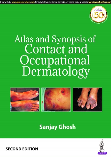 Бумажная книга «Atlas and Synopsis of Contact and Occupational Dermatology», автор Санджай Гхош - фото №1