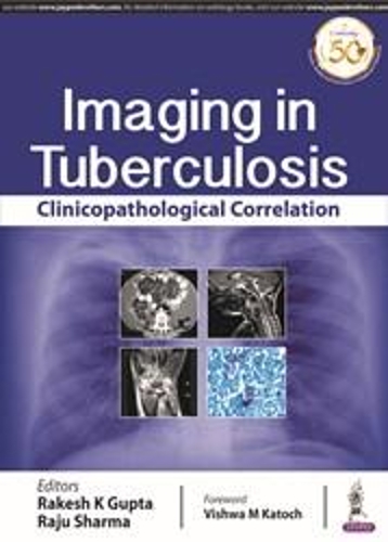 Паперова книга «Imaging in Tuberculosis: Clinicopathological Correlation», авторів Раджу Шарма, Ракеш К. Гупта - фото №1