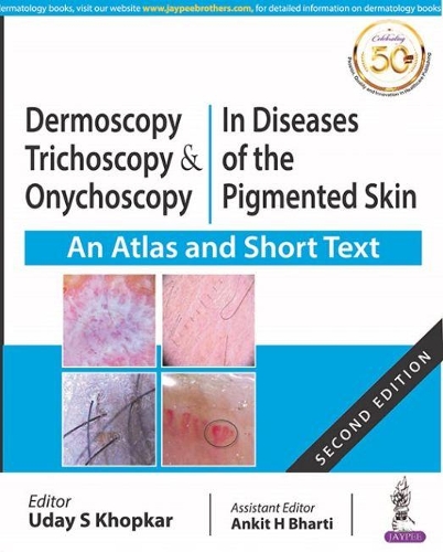 Бумажная книга «Dermoscopy, Trichoscopy and Onychoscopy in Diseases of the Pigmented Skin: An Atlas and Short Text», авторов Анкит Бхарти, Удей Хопкар - фото №1
