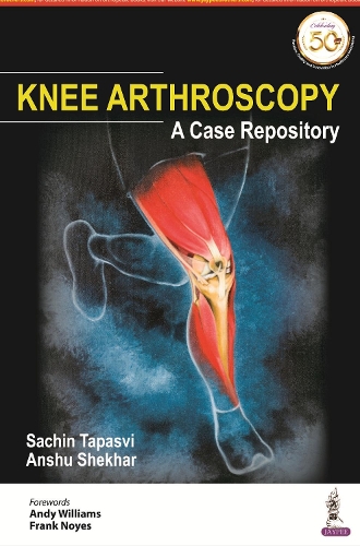 Бумажная книга «Knee Arthroscopy: A Case Repository», авторов Аншу Шекхар, Сачин Тапасви - фото №1
