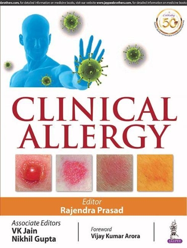 Паперова книга «Clinical Allergy», авторів Нікхіл Гупта, Раджендра Прасад, ВК Джайн - фото №1