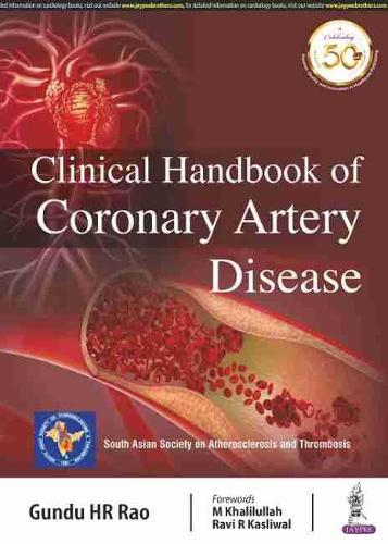 Паперова книга «Clinical Handbook of Coronary Artery Disease», автор Гунду ХР Рао - фото №1