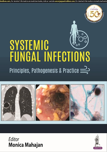Бумажная книга «Systemic Fungal Infections: Principles, Pathogenesis & Practice», автор Моника Махаджан - фото №1
