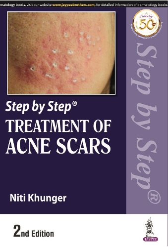 Паперова книга «Step by Step Treatment of Acne Scars», автор Ніті Кхунґер - фото №1