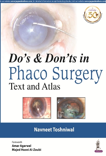 Бумажная книга «Do's & Dont's in Phaco Surgery: Text and Atlas», автор Навнит Тошнивал - фото №1