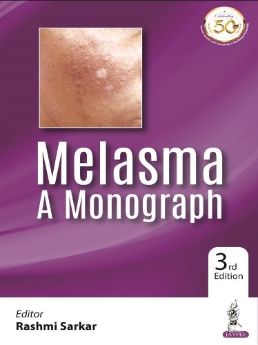 Паперова книга «Melasma: A Monograph», автор Рашмі Саркар - фото №1