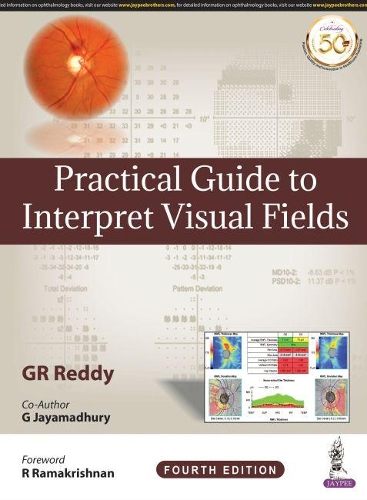 Бумажная книга «Practical Guide to Interpret Visual Fields», автор Г. Р. Редди - фото №1