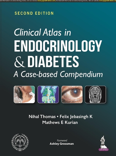 Паперова книга «Clinical Atlas in Endocrinology and Diabetes: A Case-based Compendium», авторів Фелікс Джебасінгх К, Метью Е. Куріан, Ніхаль Томас - фото №1