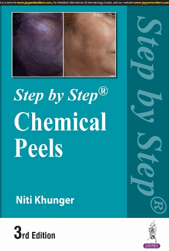 Бумажная книга «Step by Step: Chemical Peels», автор Нити Кхунгер - фото №1