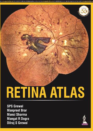 Бумажная книга «Retina Atlas», авторов Дилрадж С Грюал, Мангат Рам Догра, Манприт Брар, Манси Шарма, СПС Грюал - фото №1
