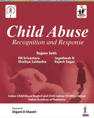 Паперова книга «Child Abuse: Recognition and Response», авторів Джагадіш Н, РН Шрівастава, Раджив Сет, Раджеш Сагар, Шайбія Салданья - фото №1