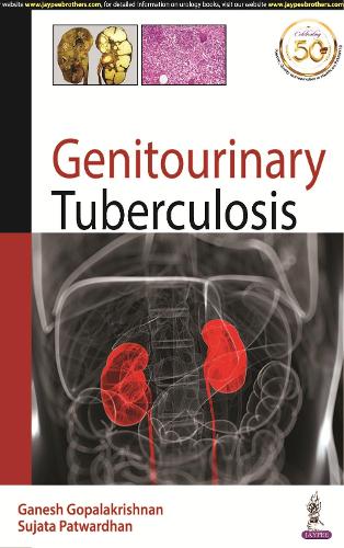 Паперова книга «Genitourinary Tuberculosis», авторів Ганеш Гопалакрішнан, Суджата К. Патвардхан - фото №1