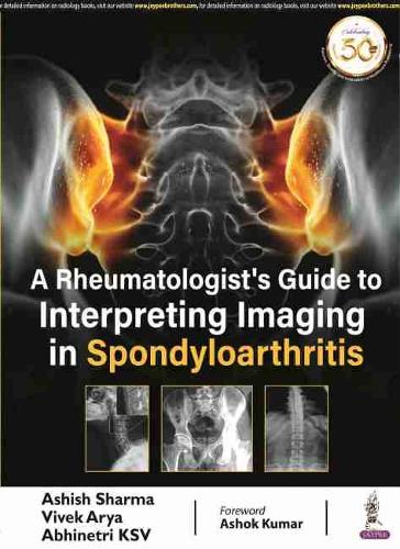 Паперова книга «A Rheumatologist's Guide to Interpreting Imaging in Spondyloarthritis», авторів Абхінетрі KСВ, Ашіш Шарма, Вівек Ар'я - фото №1