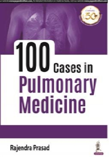 Паперова книга «100 Cases in Pulmonary Medicine», автор Раджендра Прасад - фото №1