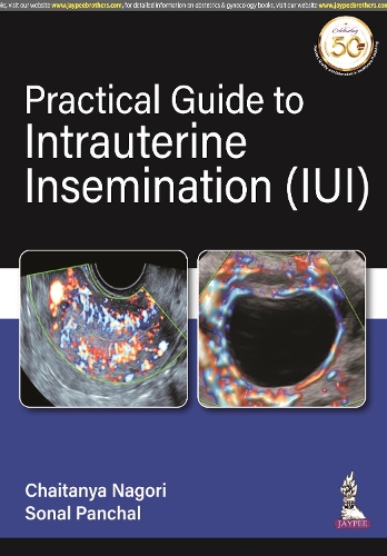 Паперова книга «Practical Guide to Intrauterine Insemination (IUI)», авторів Чайтанья Наґорі, Сонал Панчал - фото №1