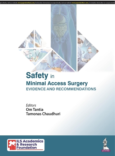 Бумажная книга «Safety in Minimal Access Surgery: Evidence and Recommendations», авторов Ом Тантия, Тамонас Чаудхури - фото №1