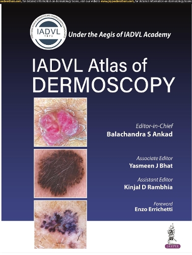Паперова книга «Atlas of Dermoscopy», авторів Балачандра С Анкад, Кінджал Д Рамбхіа, Ясмін Джей Бхат - фото №1