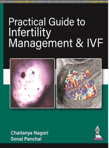 Паперова книга «Practical Guide to Infertility Management & IVF», авторів Чайтанья Наґорі, Сонал Панчал - фото №1