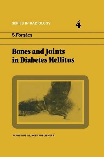 Бумажная книга «Bones and Joints in Diabetes Mellitus», автор С. Форгач - фото №1