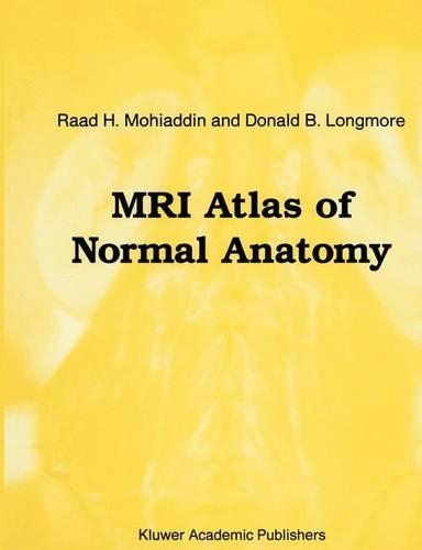 Паперова книга «MRI Atlas of Normal Anatomy», авторів Д.Б. Лонгмор, Раад Х. Мохіаддін - фото №1
