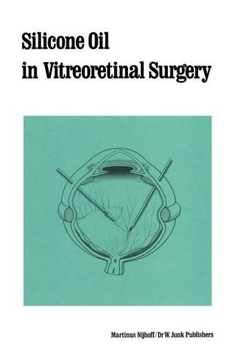 Паперова книга «Silicone Oil in Vitreoretinal Surgery», автор Р. Живойновіч - фото №1