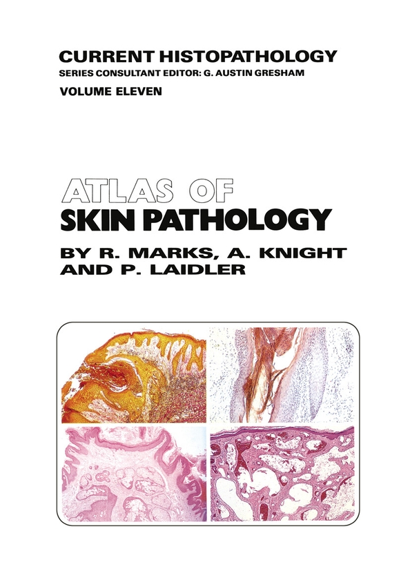 Паперова книга «Atlas of Skin Pathology», авторів А. Г. Найт, П. Лайдлер, Р. М. Маркс - фото №1