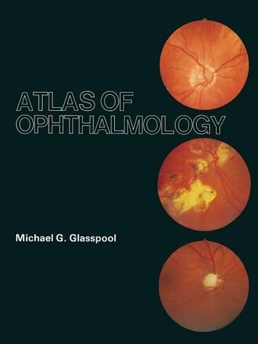 Паперова книга «Atlas of Ophthalmology», автор М. Г. Гласспул - фото №1