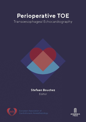 Паперова книга «Perioperative TOE: Transoesophageal Echocardiography», автор Стефан Буше - фото №1